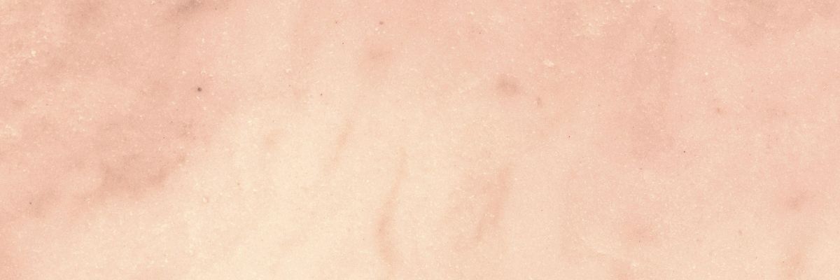 Why Local Advertising Breaks Without Local Landing Pages